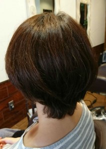 Oさん 施術前