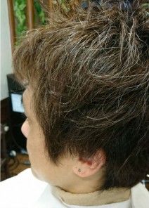 Tさん 施術前
